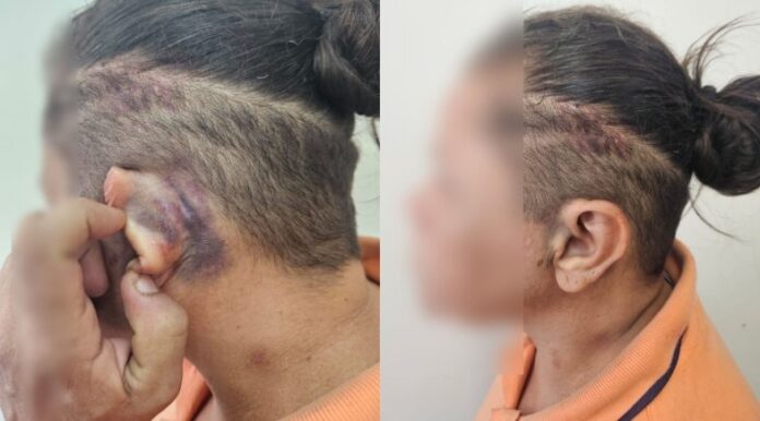 mulher-e-trancada-em-porta-malas-e-ameacada-apos-ser-acusada-de-sumico-de-jovem-em-teresina-ec4f2b68-c6f1-43d4-a1f5-b265d648c64a (1)