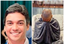 Prefeito de Angical, Bruno Neto, completa um ano de luta contra a leucemia e compartilha relato emocionante nas redes sociais